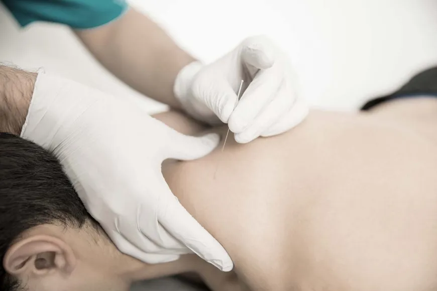 Dry needling behandeling bij PremiumCare Fysiotherapie Nijmegen